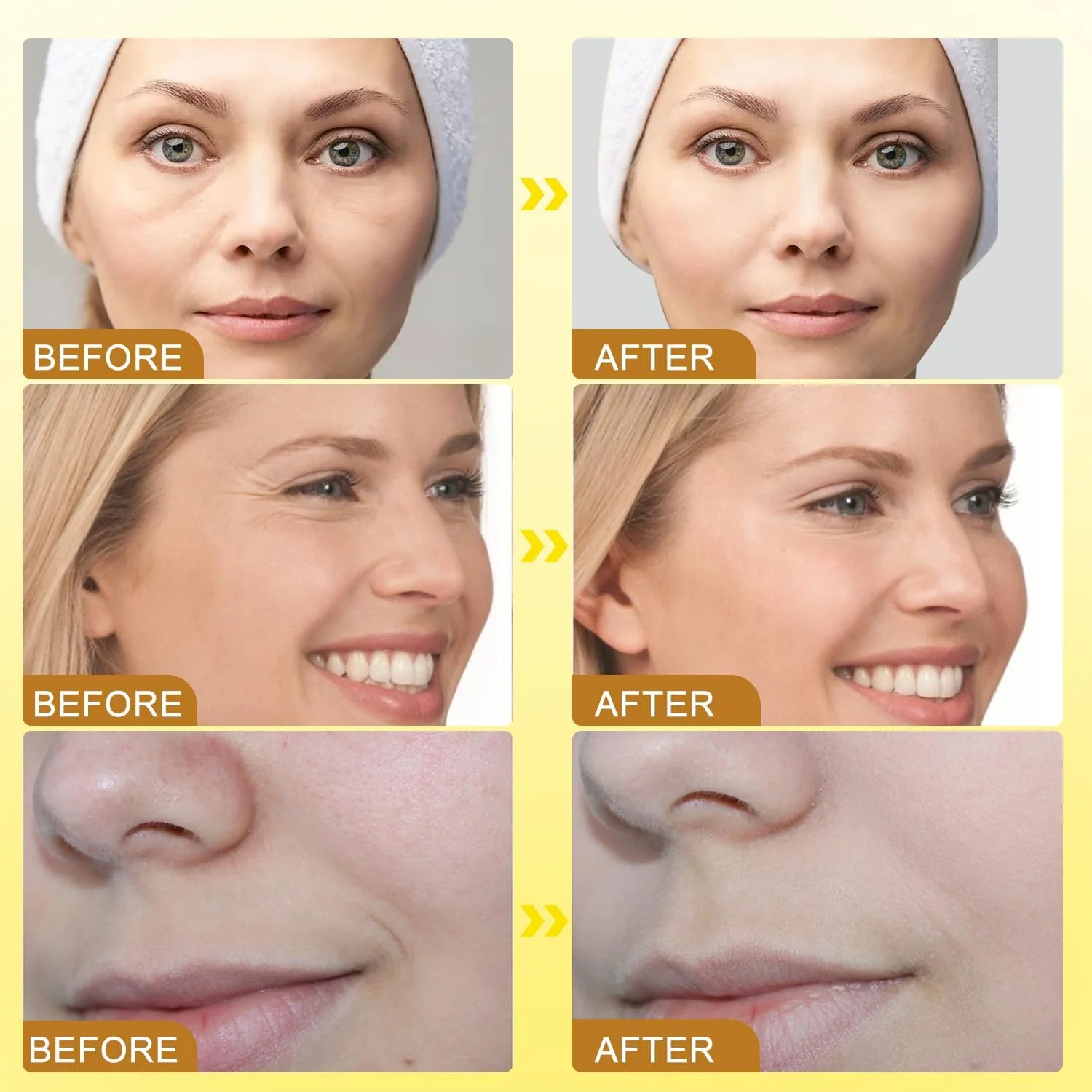 Bee Venom Botox Wrinkle Anti Aging Cream - Image 4