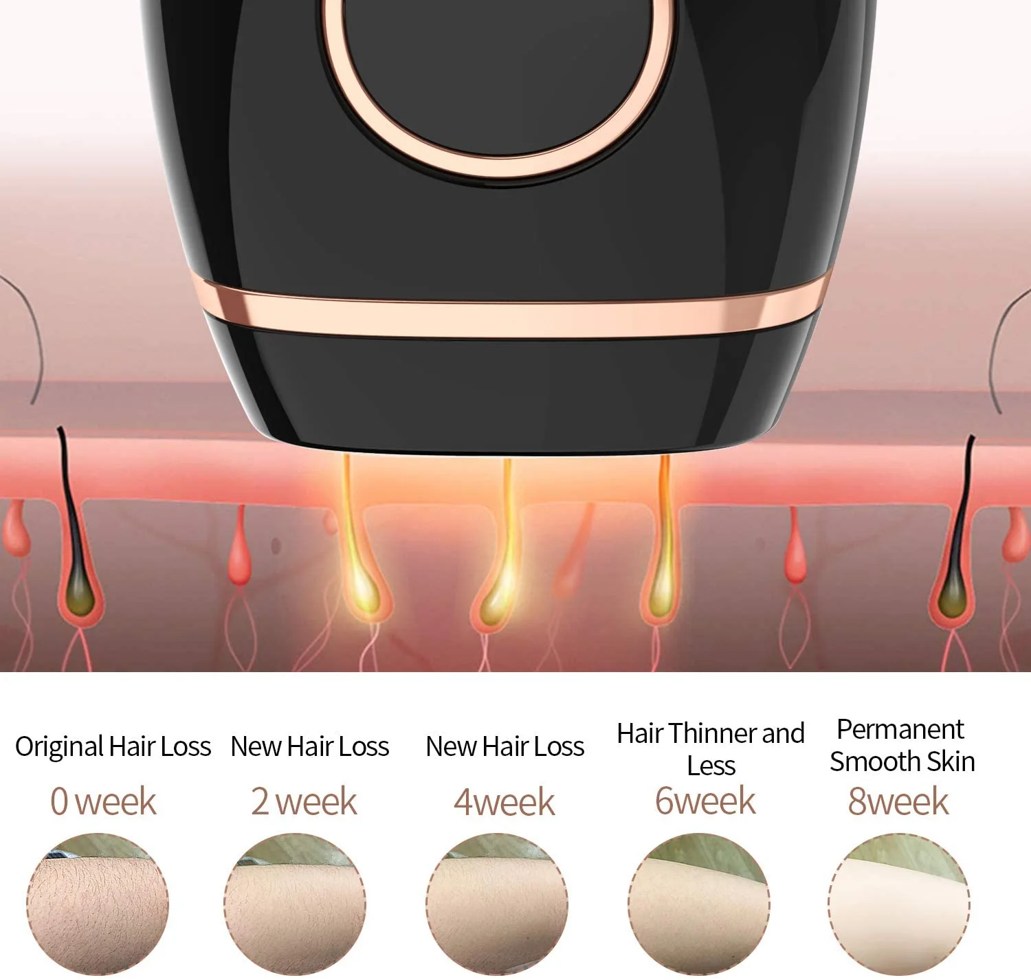 IPL Hair Removal System, Permanent Painless 999,999 Flashes - Image 3