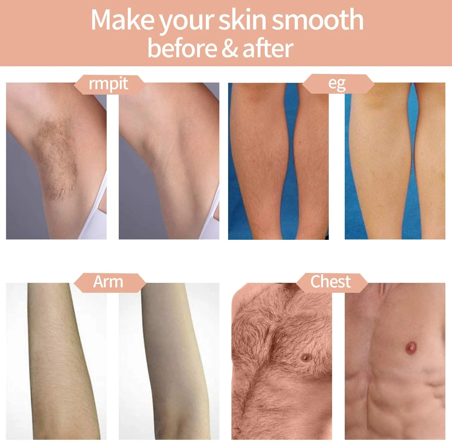 IPL Hair Removal System, Permanent Painless 999,999 Flashes - Image 8